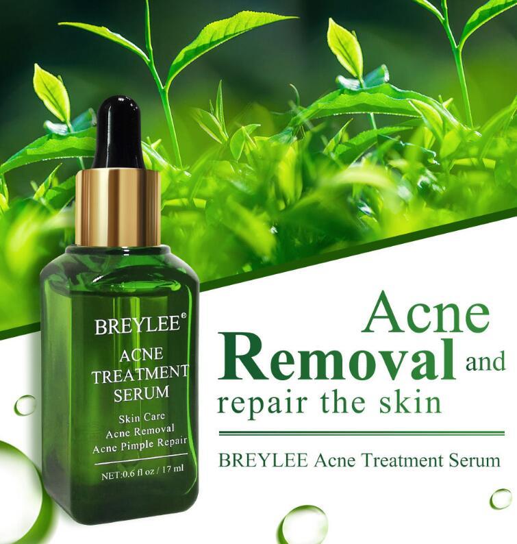 Acne Treatment Serum Facial Repair Oil - Image 2