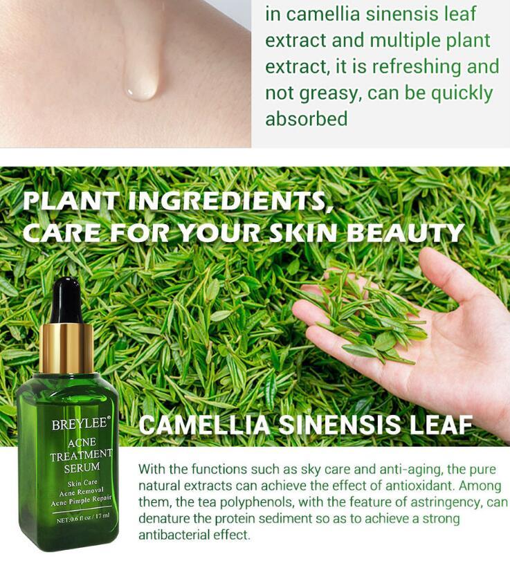 Acne Treatment Serum Facial Repair Oil - Image 4